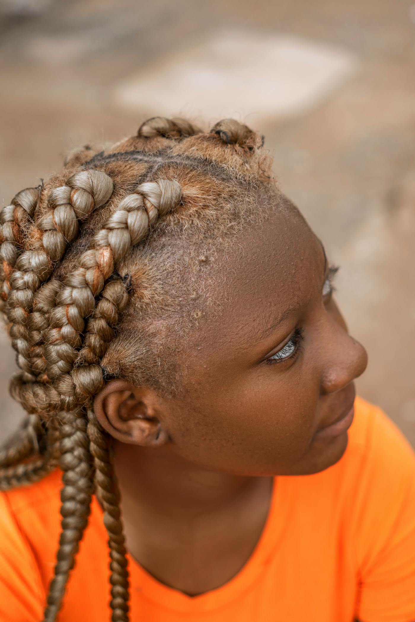 Feed-in straight-back braids, top view, honey-blonde